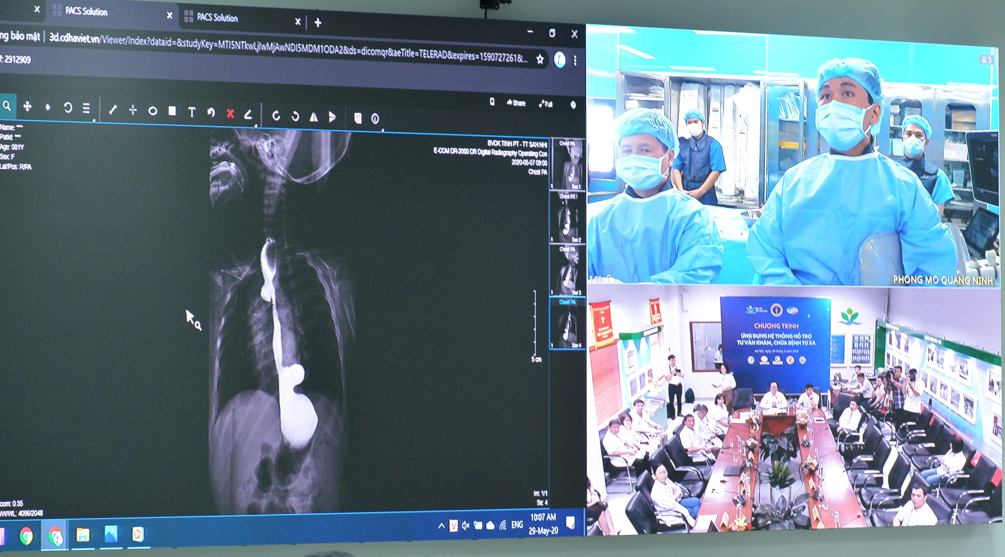 GIẢI PHÁP HỘI NGHỊ TRUYỀN HÌNH CHO NGÀNH Y TẾ – ĐỘT PHÁ CÔNG NGHỆ TELEMEDICINE 4.0